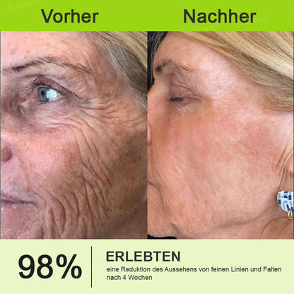 💛🐬Jetzt jugendliche Haut zurückgewinnen 💫Rolimey® Botox & Vita-A Retinol Shot Falten-Lift Straffungscreme