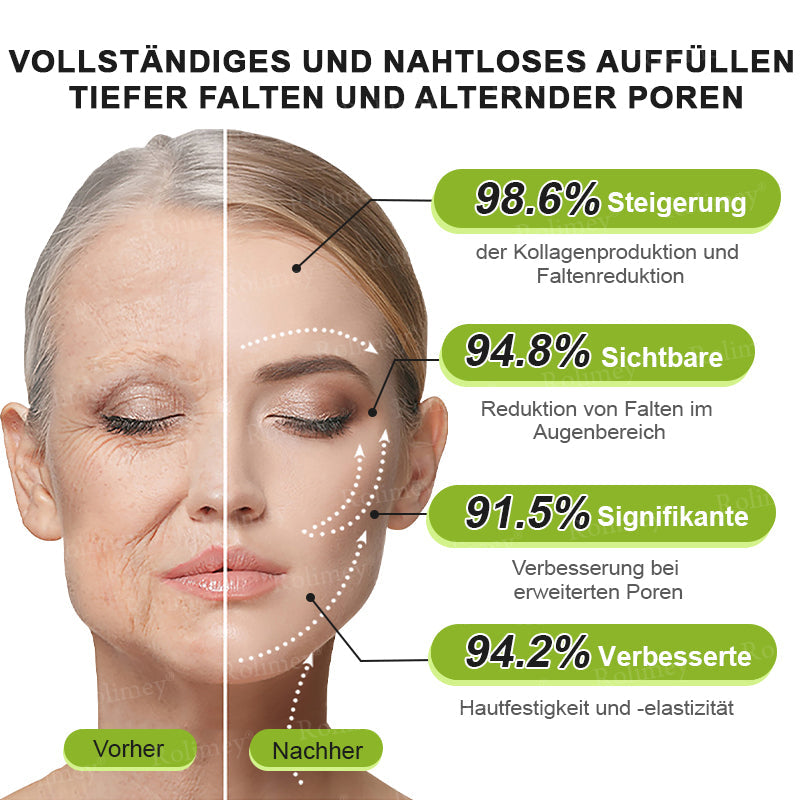 💛🐬Jetzt jugendliche Haut zurückgewinnen 💫Rolimey® Botox & Vita-A Retinol Shot Falten-Lift Straffungscreme