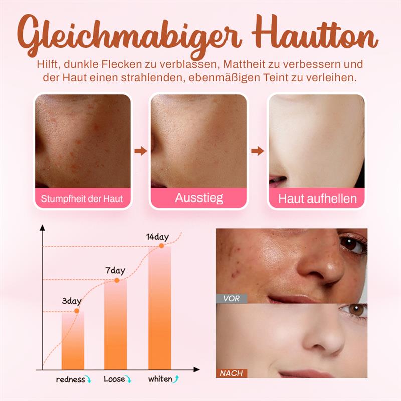 Seurico™ Aufhellende und Sommersprossen-entfernende Maske