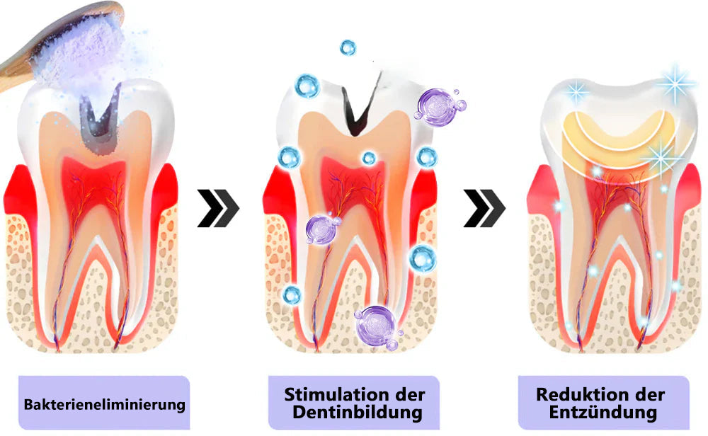 Blitzangebot 😍 – Nicht verpassen! – ODEIUN™ Mineralpulver zur Zahnreparatur 🦷 (von der BZÄK empfohlen)
