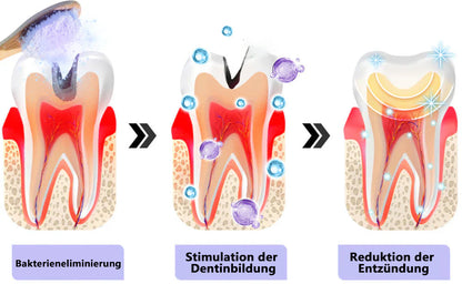 Blitzangebot 😍 – Nicht verpassen! – ODEIUN™ Mineralpulver zur Zahnreparatur 🦷 (von der BZÄK empfohlen)