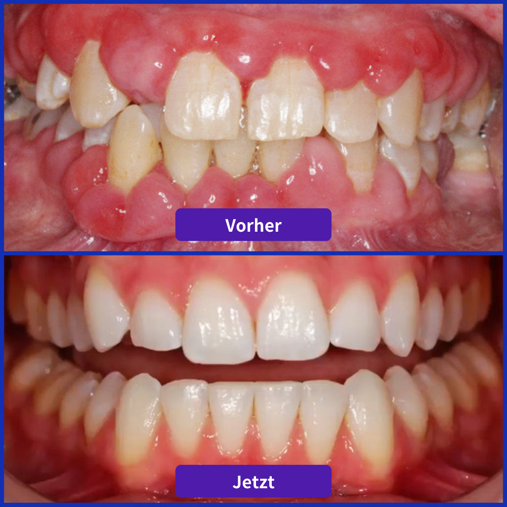 Odeiun® VioCore Zahnpasta mit Bienengift zur Zahnbehandlung