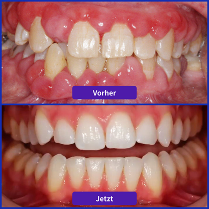 Odeiun® VioCore Zahnpasta mit Bienengift zur Zahnbehandlung