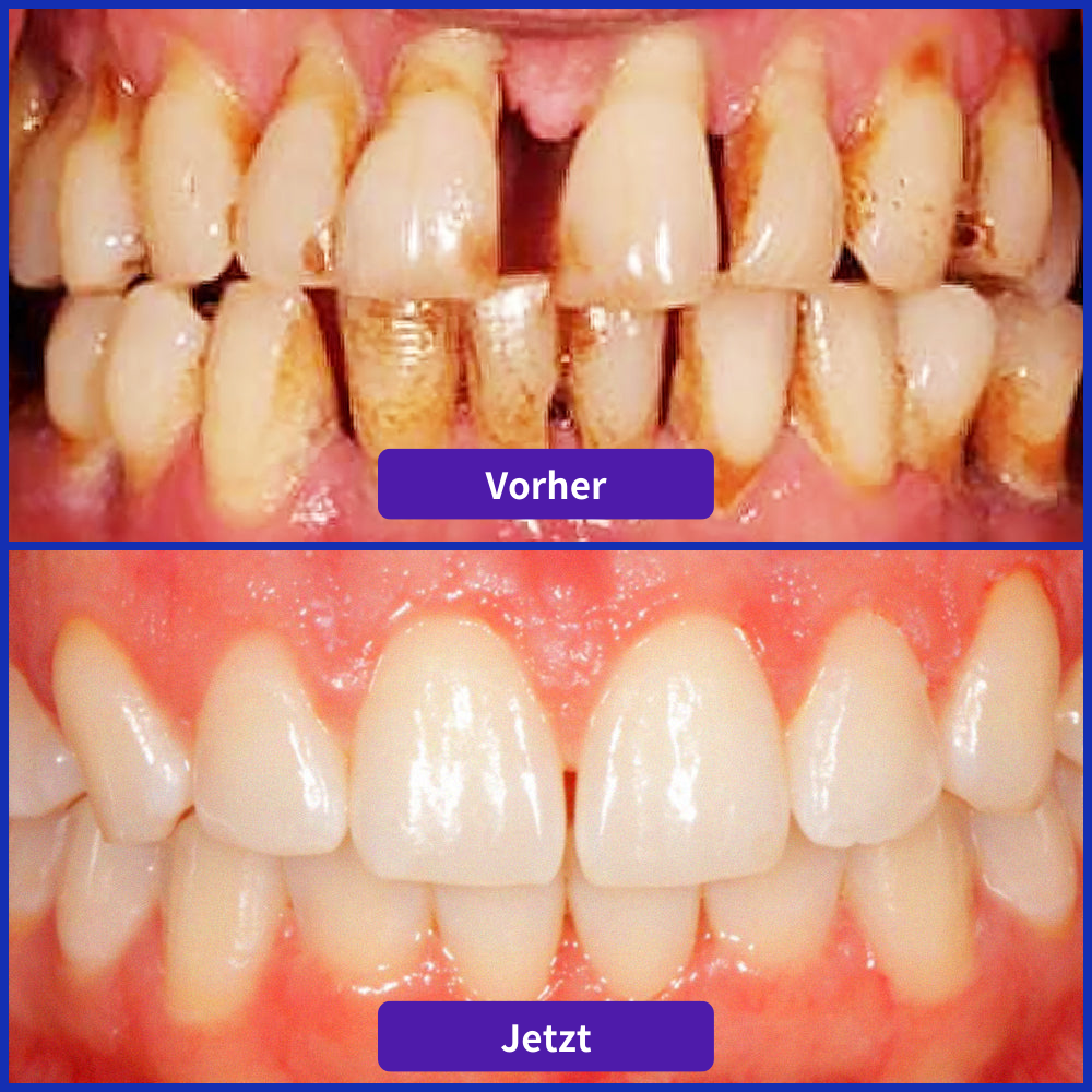 Odeiun® VioCore Zahnpasta mit Bienengift zur Zahnbehandlung