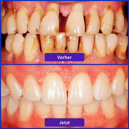 Odeiun® VioCore Zahnpasta mit Bienengift zur Zahnbehandlung