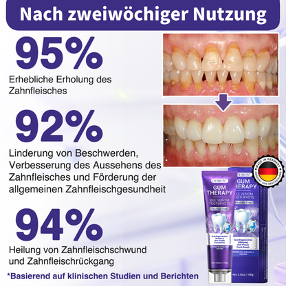 Odeiun® VioCore Zahnpasta mit Bienengift zur Zahnbehandlung