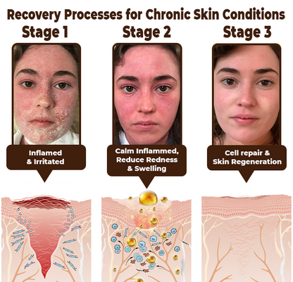 Zakdavi™ Emu-Öl - Reparaturcreme für den ganzen Körper