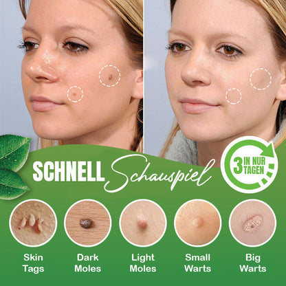 Seurico™ Natürliches Hautwarzen Kräuterentfernungs-Pflaster