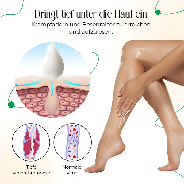 VasCulear™ Venentherapie-Creme