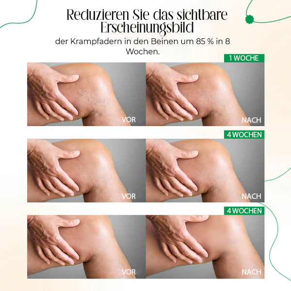 VasCulear™ Venentherapie-Creme