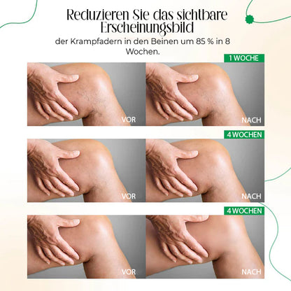 VasCulear™ Venentherapie-Creme