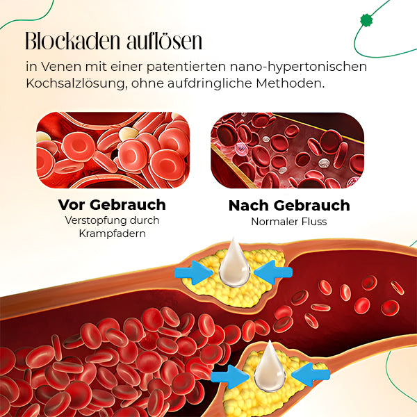 VasCulear™ Venentherapie-Creme