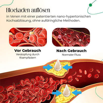 VasCulear™ Venentherapie-Creme