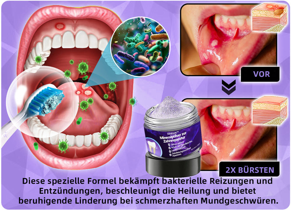 Blitzangebot 😍 – Nicht verpassen! – ODEIUN™ Mineralpulver zur Zahnreparatur 🦷 (von der BZÄK empfohlen)