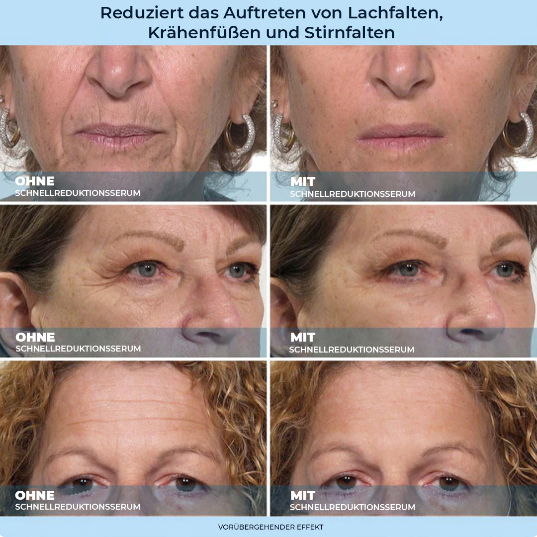 LBMLBM™ 60-Sekunden Anti-Aging-Serum gegen Falten, Augenringe & Tränensäcke