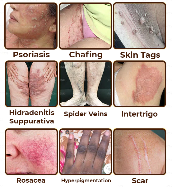 Zakdavi™ Emu-Öl - Reparaturcreme für den ganzen Körper