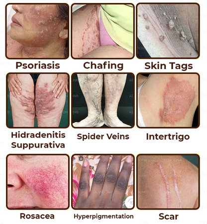 Zakdavi™ Emu-Öl - Reparaturcreme für den ganzen Körper