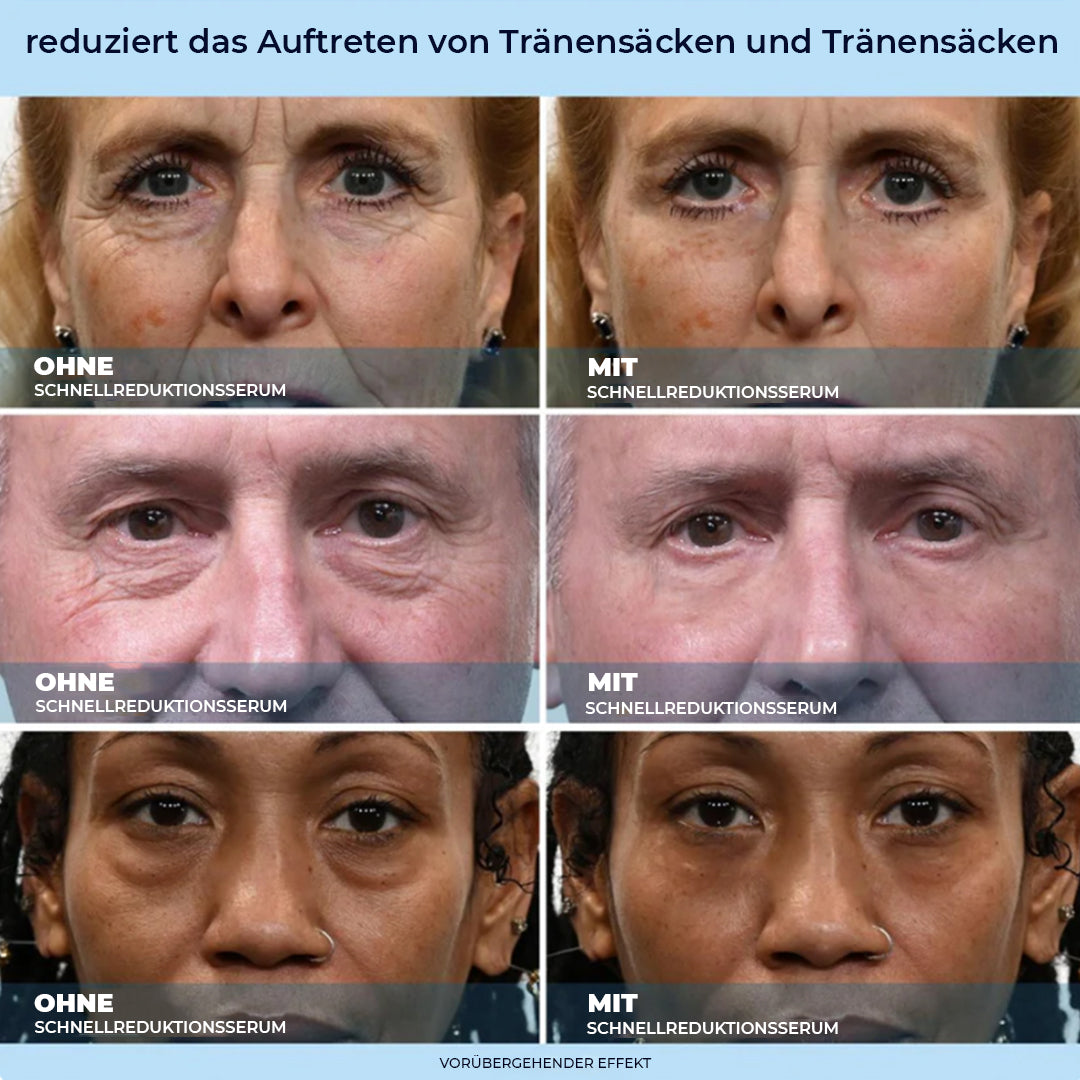 LBMLBM™ 60-Sekunden Anti-Aging-Serum gegen Falten, Augenringe & Tränensäcke