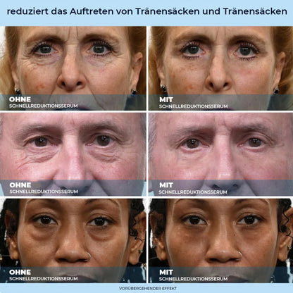 LBMLBM™ 60-Sekunden Anti-Aging-Serum gegen Falten, Augenringe & Tränensäcke