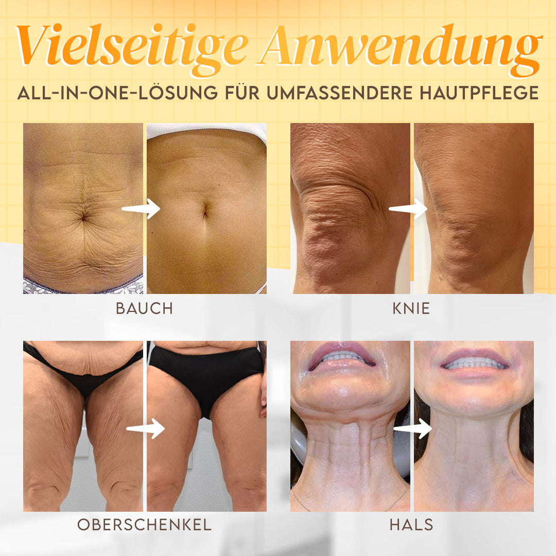 🔥Hergestellt & versandt aus den USA ✨ Venolift™ Bienengift-Komplexcreme 🔥 NUR NOCH HEUTE 80% RABATT