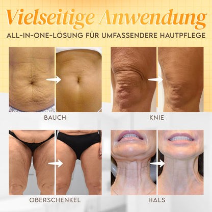 🔥Hergestellt & versandt aus den USA ✨ Venolift™ Bienengift-Komplexcreme 🔥 NUR NOCH HEUTE 80% RABATT