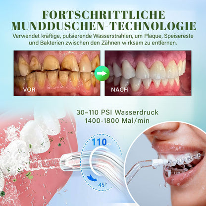 Seurico™ Wasser-Zahnseidenreiniger - kabellos, tragbar, 4 Modi 🦷