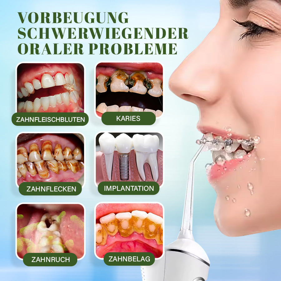 Seurico™ Wasser-Zahnseidenreiniger - kabellos, tragbar, 4 Modi 🦷