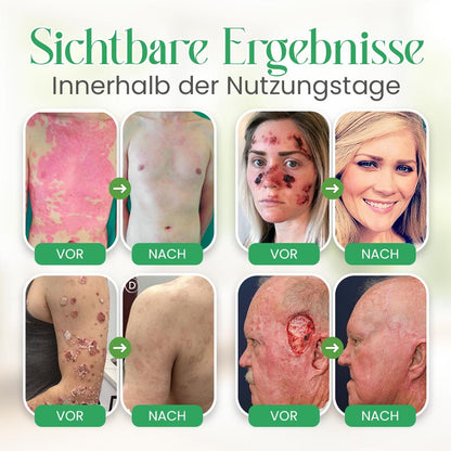 Seurico™ Handgemachte Lanolin-Creme