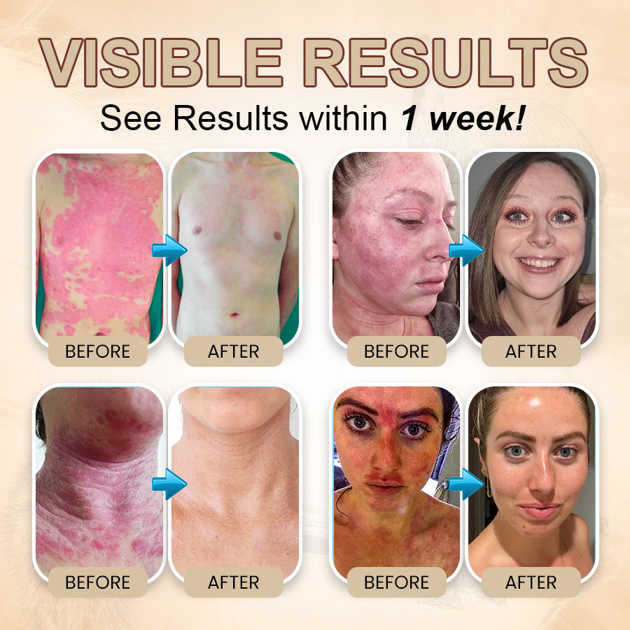 Zakdavi™ Emu-Öl - Reparaturcreme für den ganzen Körper