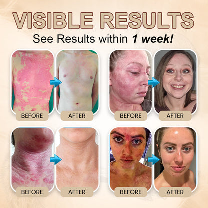 Zakdavi™ Emu-Öl - Reparaturcreme für den ganzen Körper